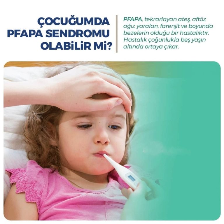 PFAPA Sendromu